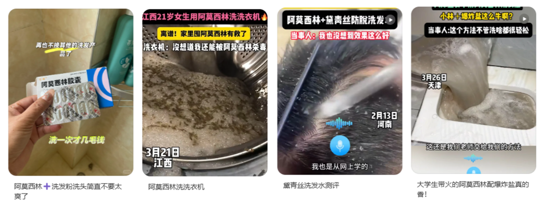 用阿莫西林洗頭，能治療脫發(fā)？別信！